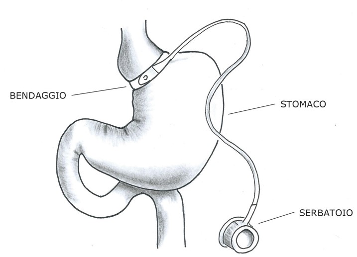 stomaco